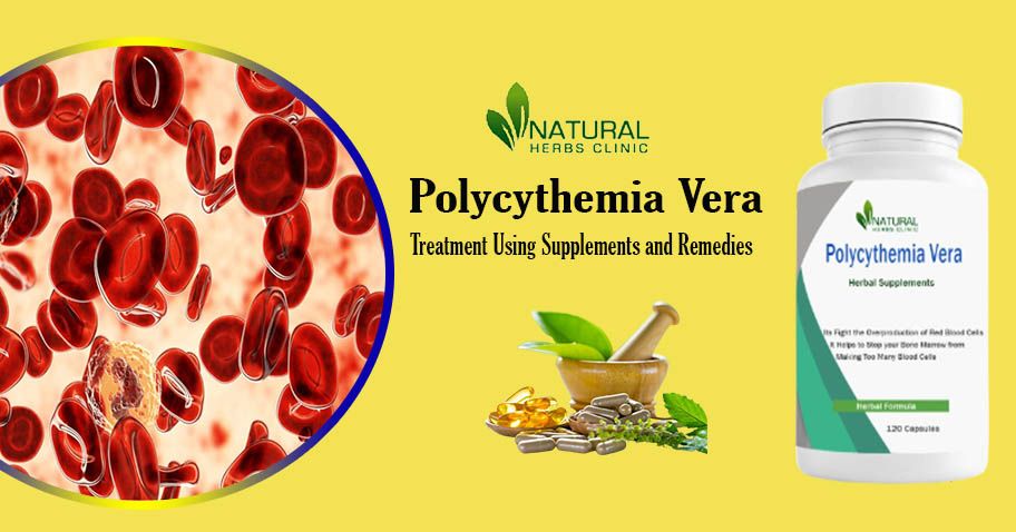 Polycythemia Vera Treatment Advancements Exploring the Latest Innovations