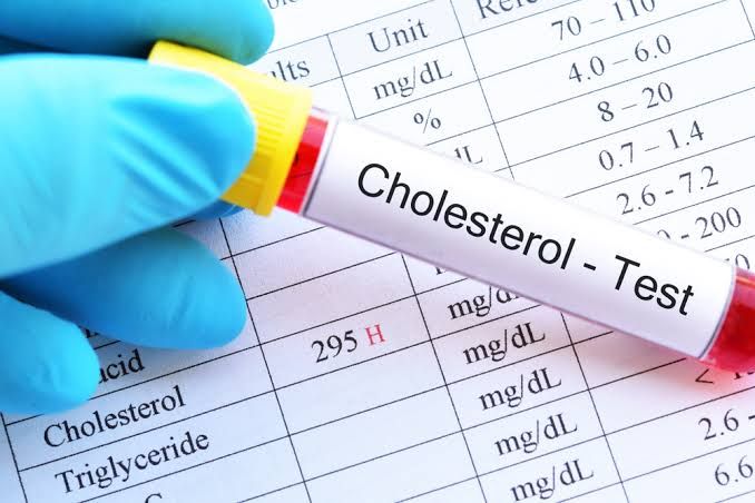 S. Cholesterol