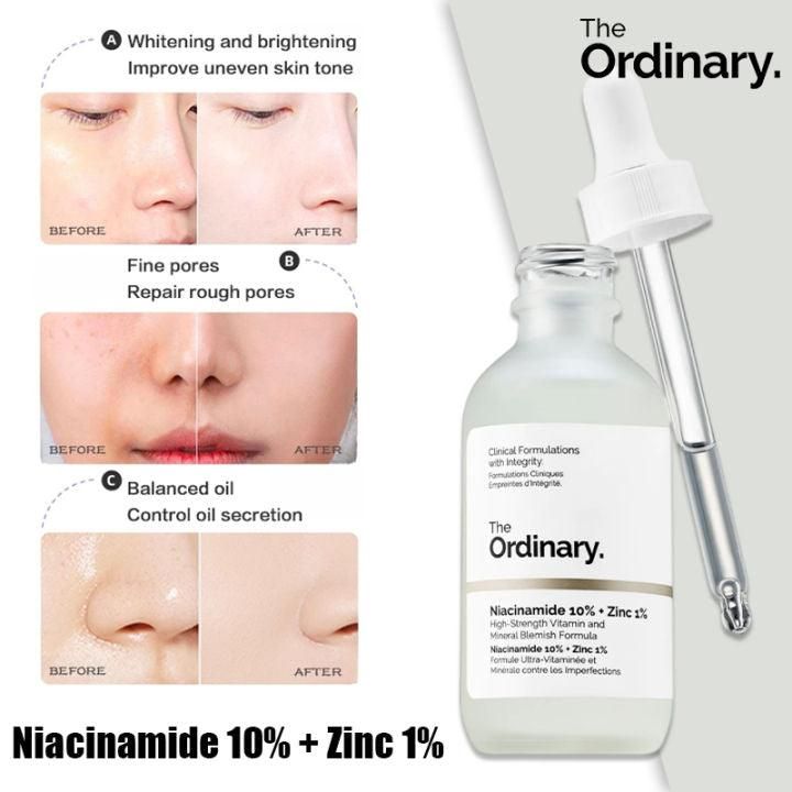 Ordinary Niacinamide serum 