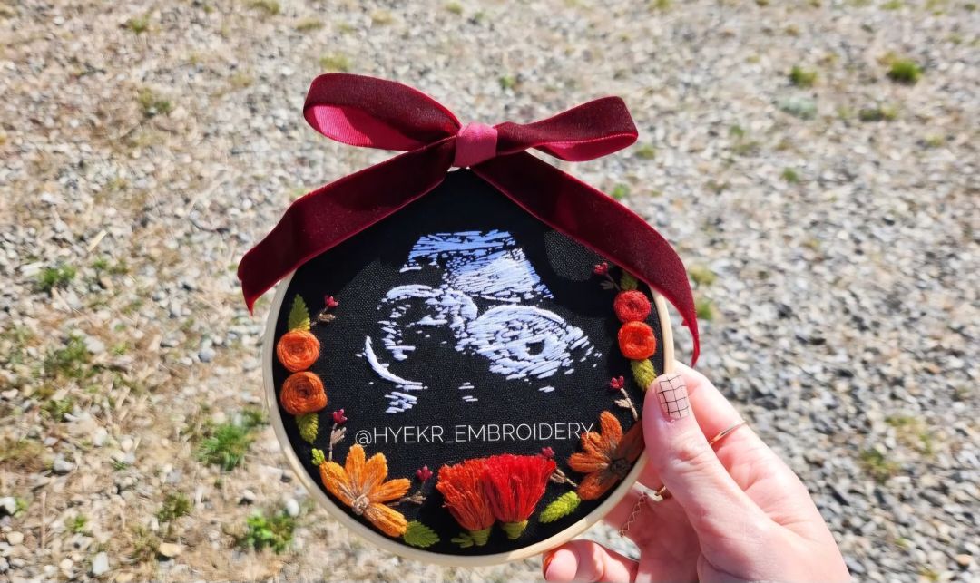 Premium Ultrasound Embroidery Hoop