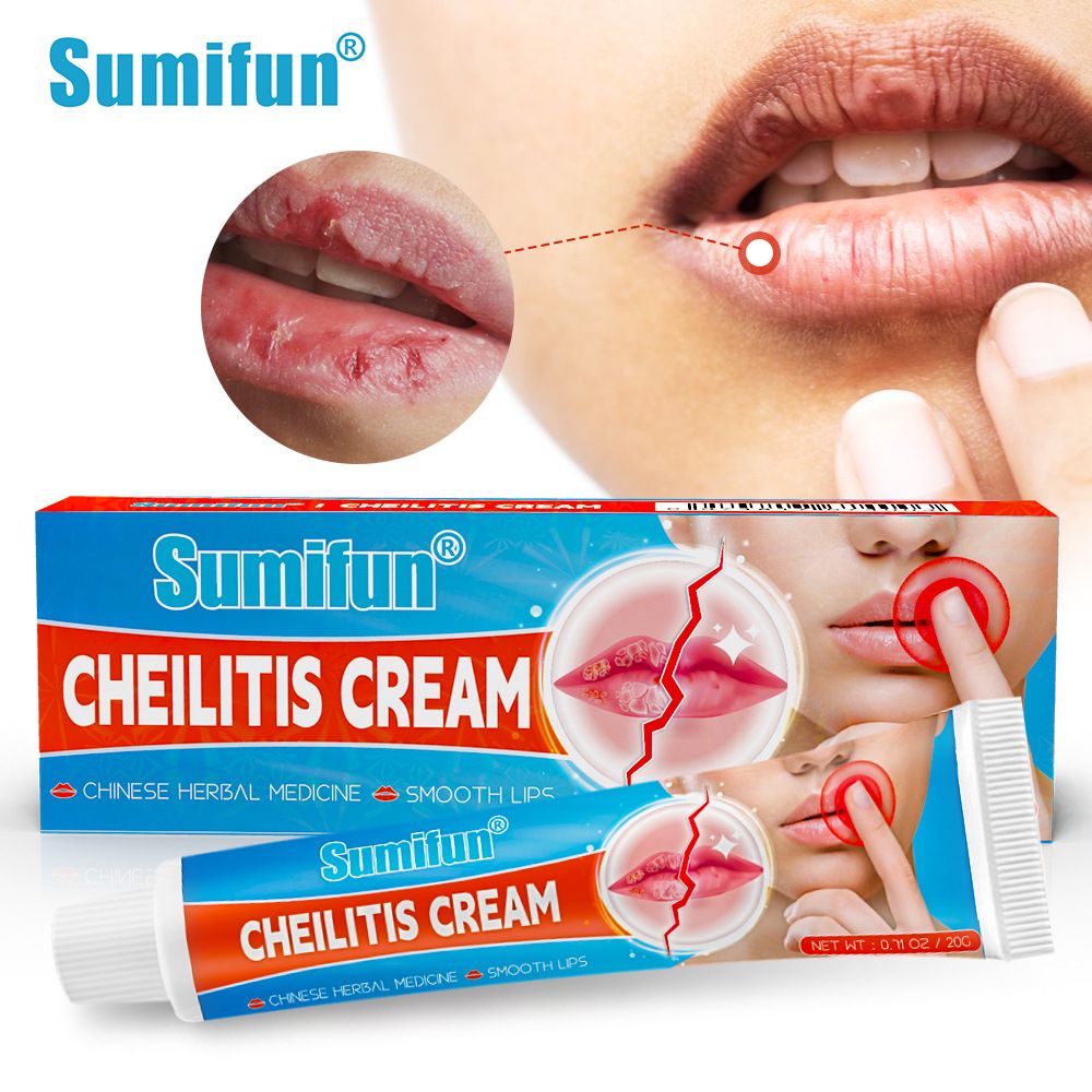 Sumifun Cheilitis Cream – Herbal Lip Care for Smooth & Healthy Lips