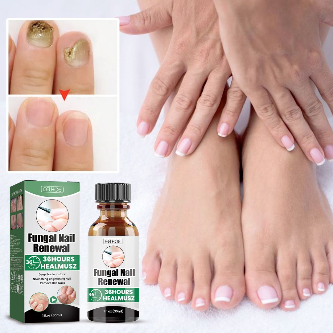 Fungal nail renewal usafiri tu