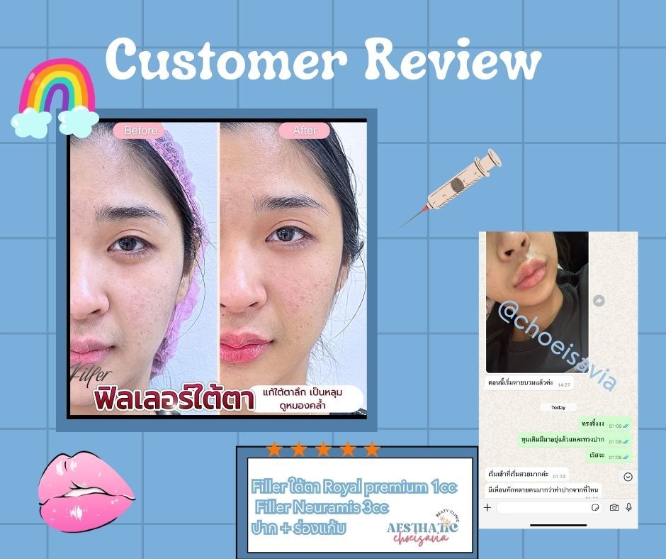 Review 🩷💉