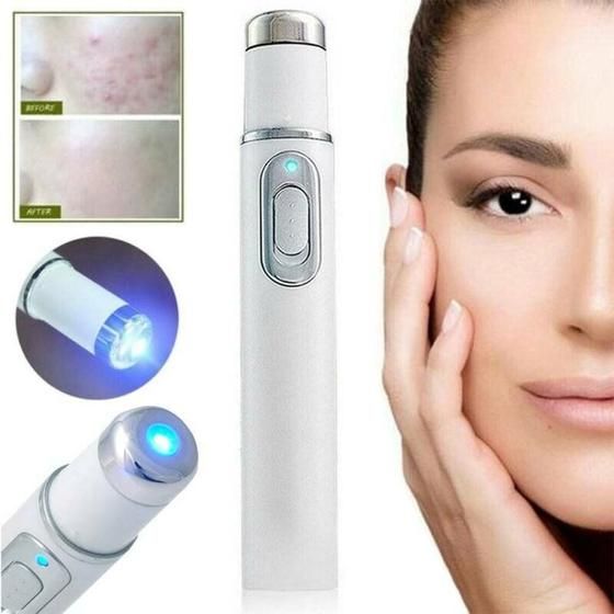 Caneta Laser Removedora de Manchas