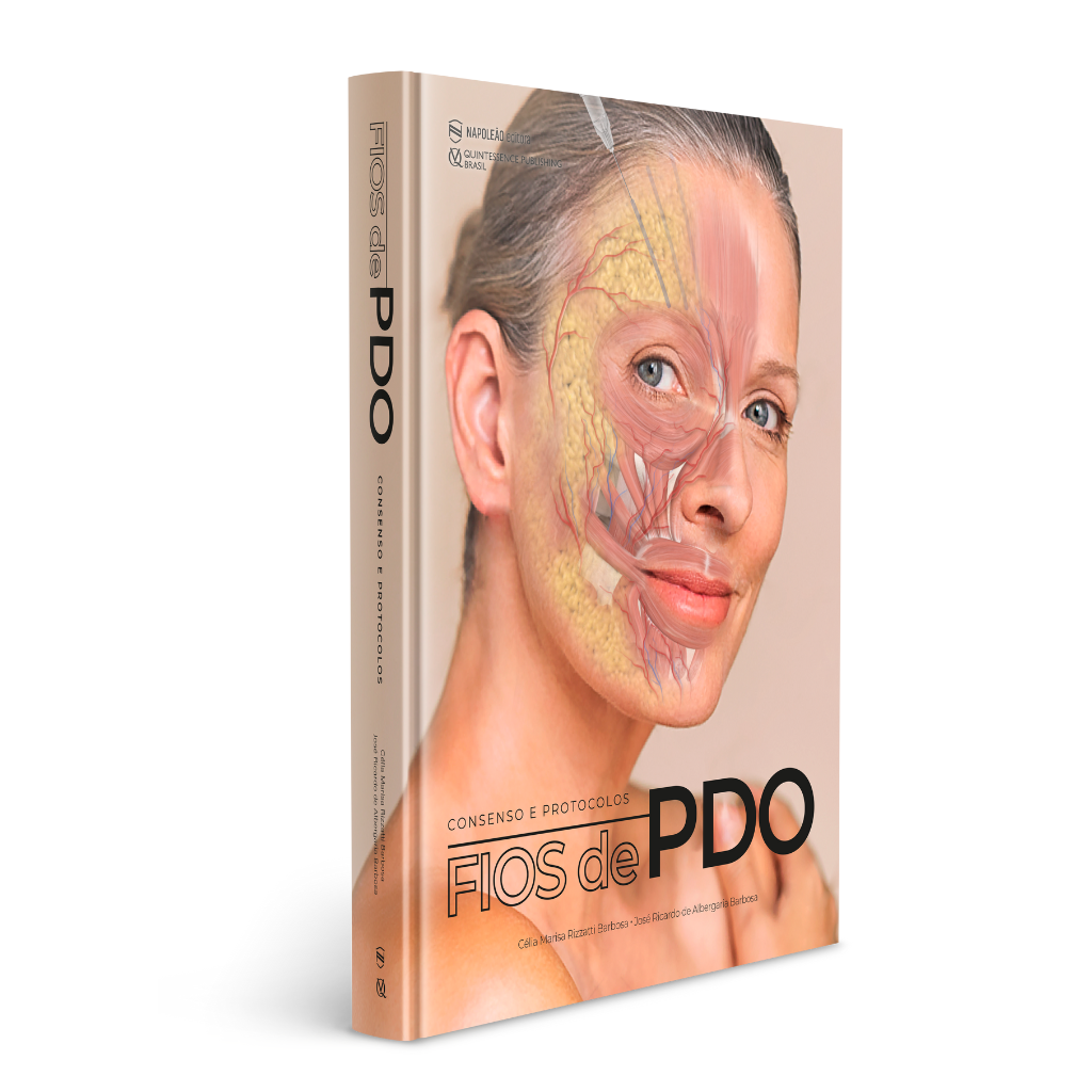 CONSENSO E PROTOCOLOS FIOS DE PDO