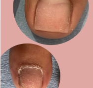 Pedicure en Seco o Preventivo