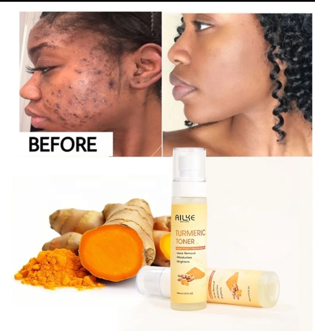 🌿 Toner Curcuma Purifiant – AILKE