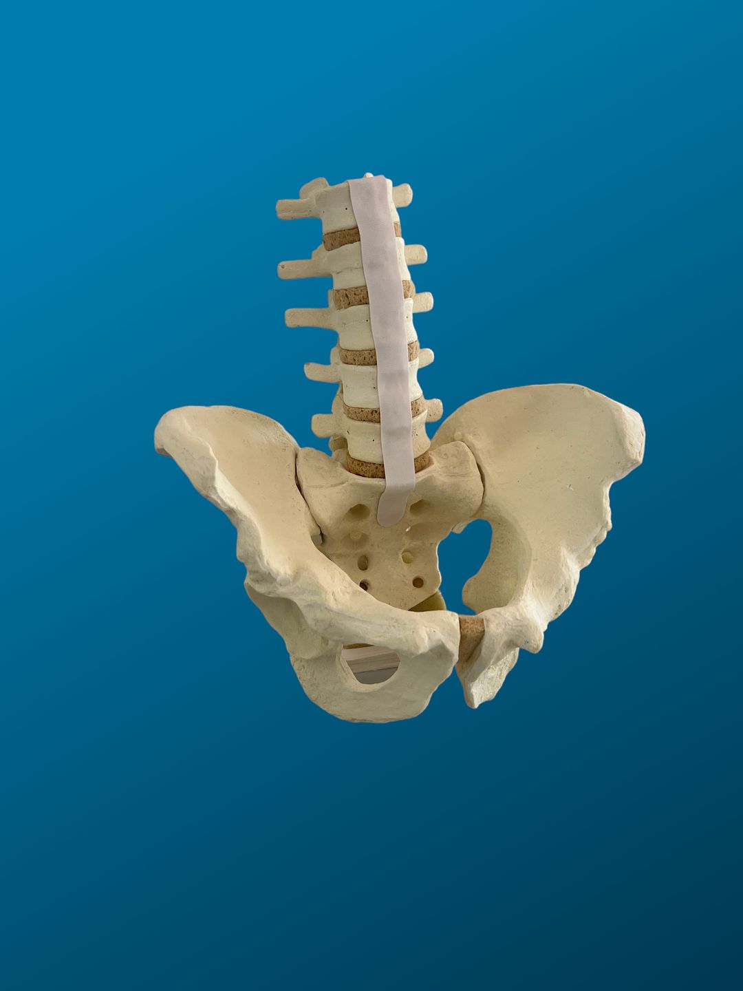 Pelvis completa con lumbares