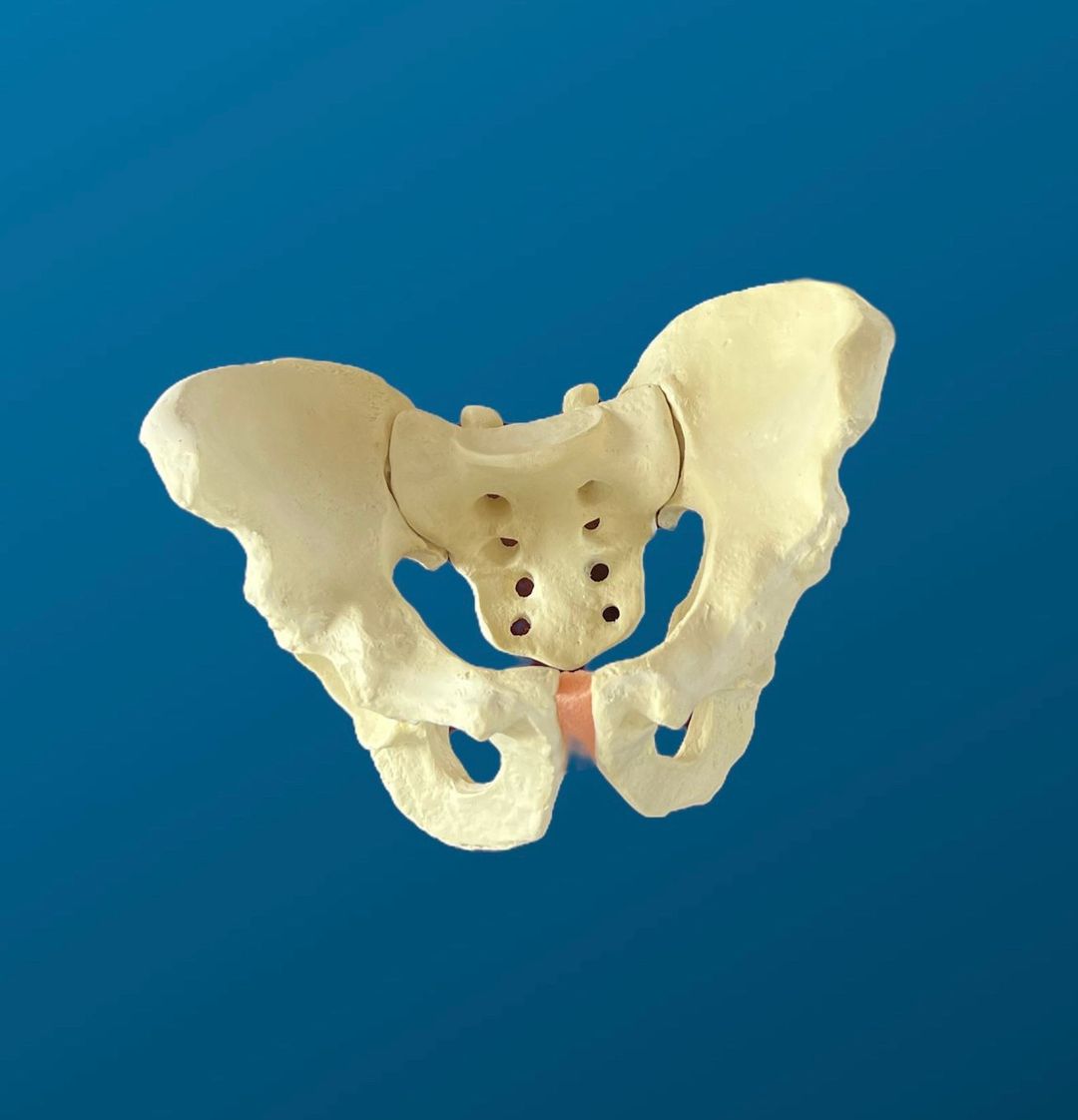 Pelvis completa con articulaciones SI (Sacro iliacas) rígidas y acetábulo de 57 mm