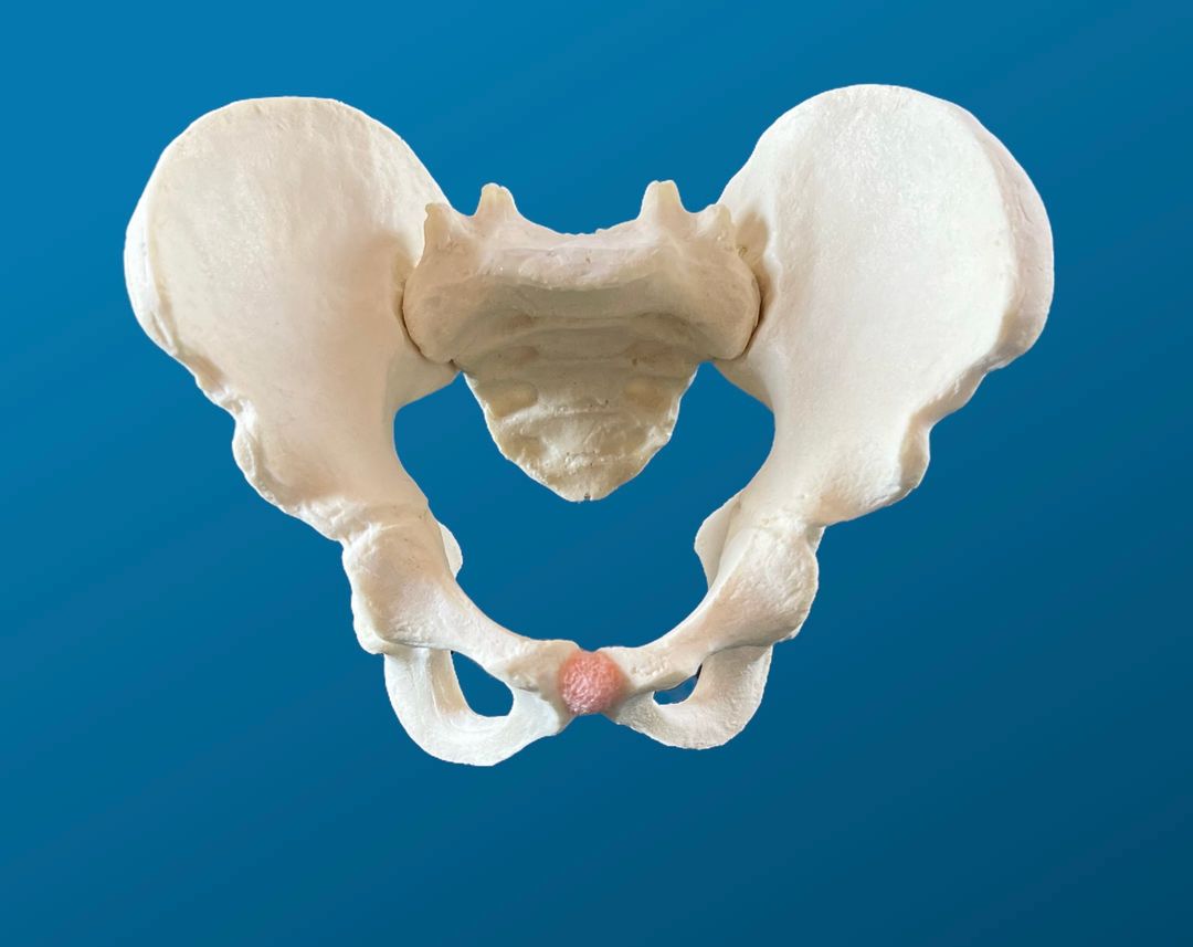 Pelvis completa pediátrica con isquion y pubis definidos. Acetábulo de 38 mm