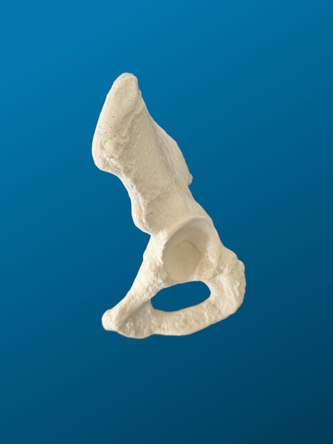 Hemipelvis pediátrica con acetábulo de 38 mm, izquierda