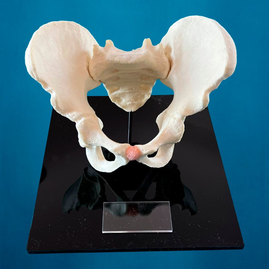 Pelvis pediátrica montada en base de acrílico. (Incluye grabado en láser personalizado.)