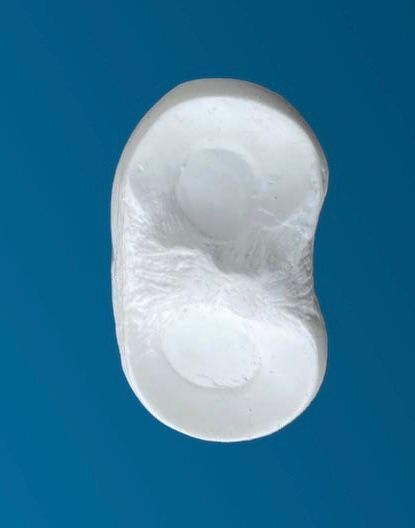Disco de menisco con elasticidad moderada.