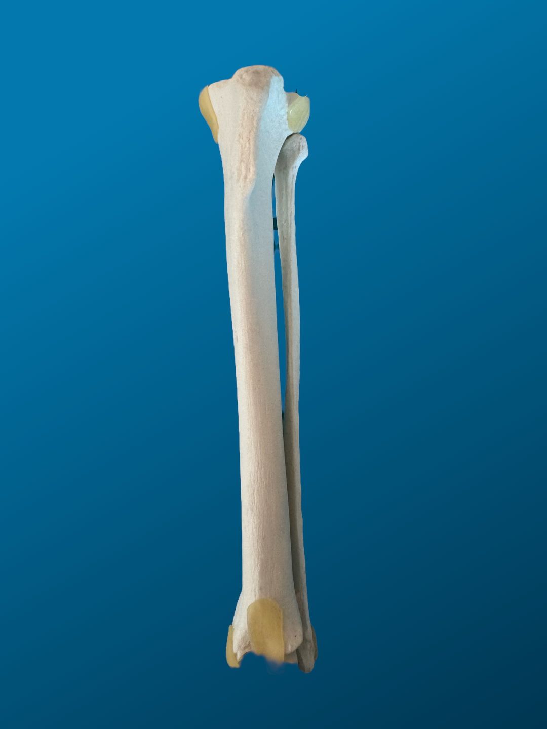 TIBIA Y PERONÉ, CANINO, ESPUMA SOLIDA