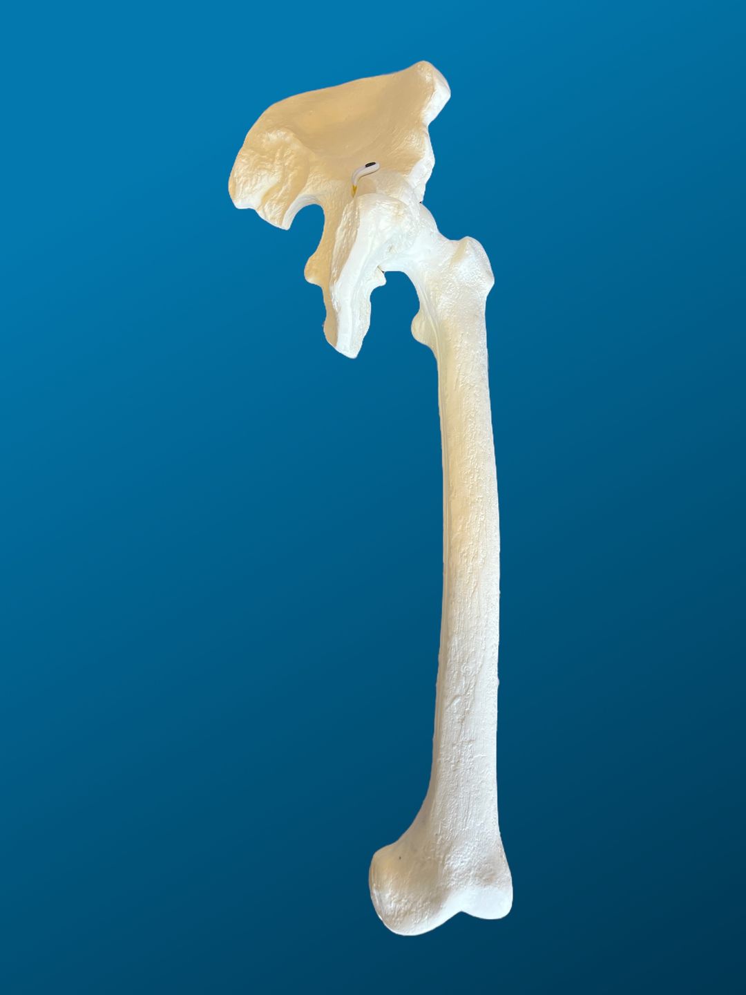 Hemipelvis con femur completo.