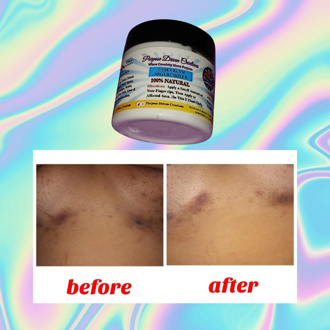 FADE CREAM/SPOT REMOVER