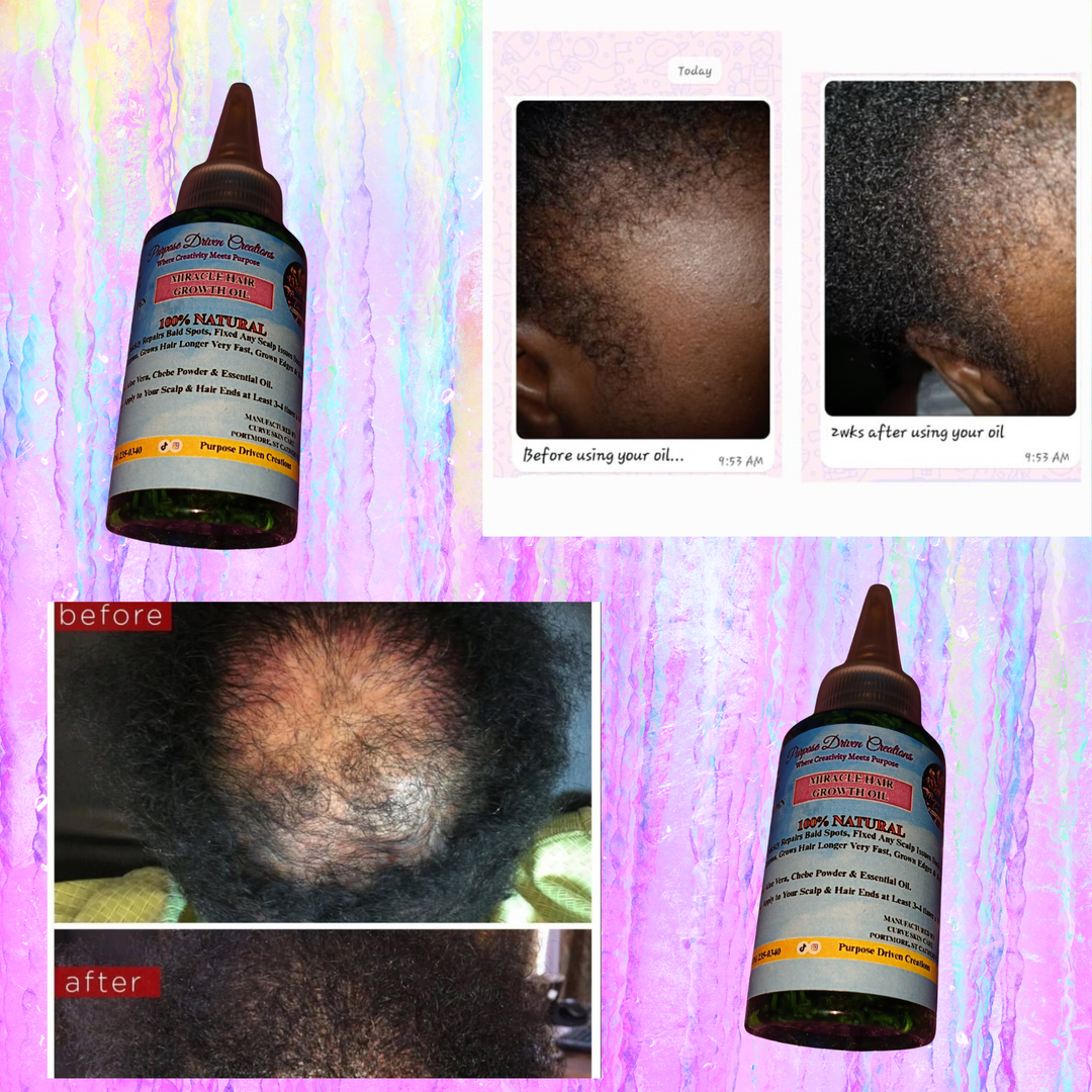 MIRACLE HAIR GROWTH OIL