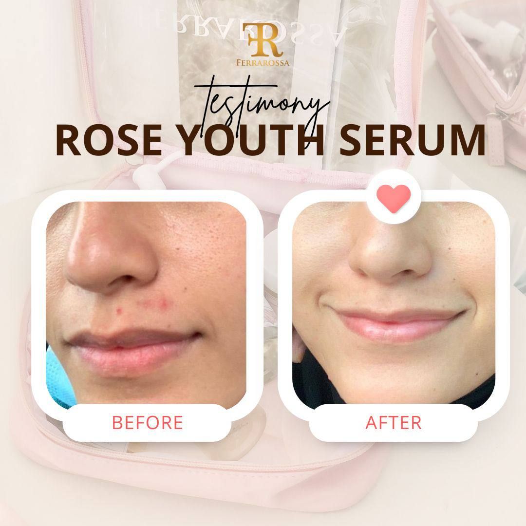 Rose Youth Serum 20ml_4