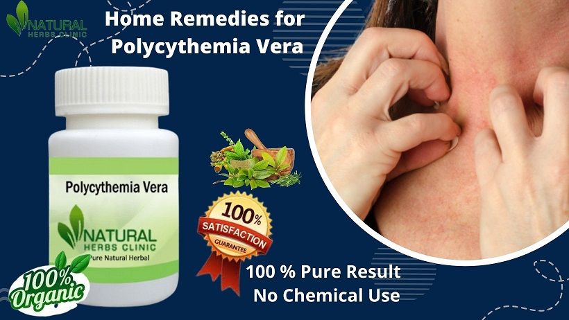 How To Utilize Polycythemia Vera Home Remedies_0