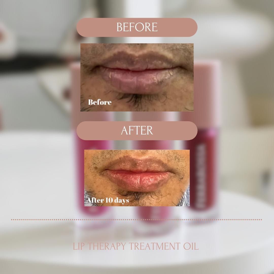 Ferrarossa Lip Therapy Treatment Oil _3