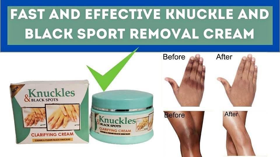 Knuckles Dark Spot Remover_0