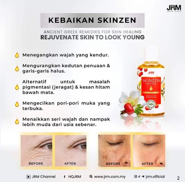 Skinzen Face Oil by JRM Bonda Rozita_2