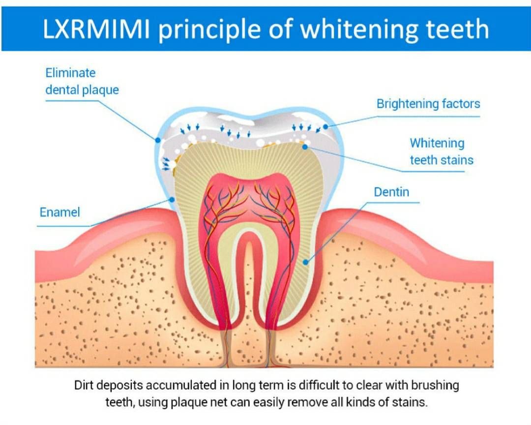 LXRMIMI Teeth Whitening liquid professional easy white teeth whitening essence_6