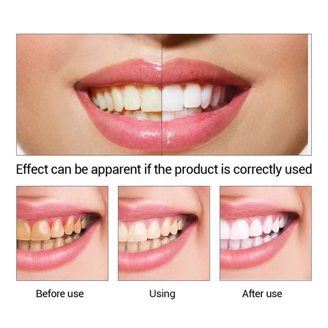 LXRMIMI Teeth Whitening liquid professional easy white teeth whitening essence_12