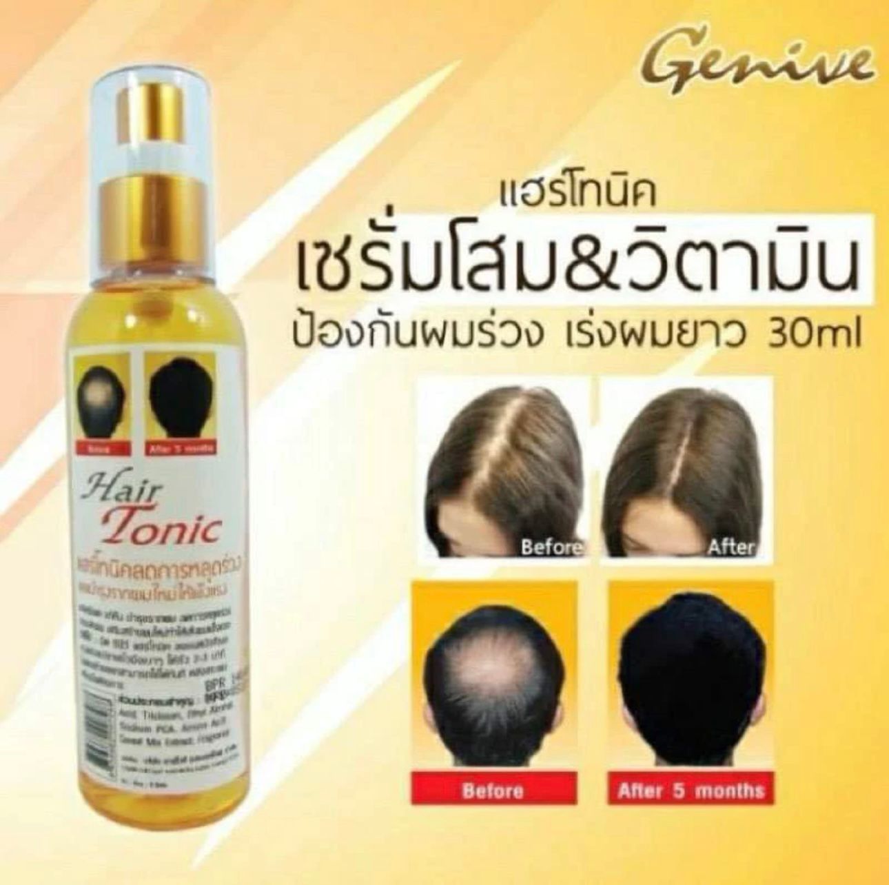 GENIVE  Hair  Tonic Anti loose_0