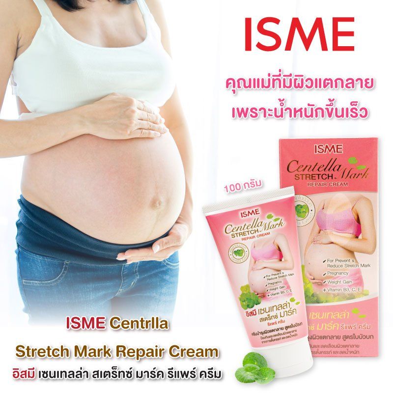 ISME Centella Stretch Mark Repair Cream_1