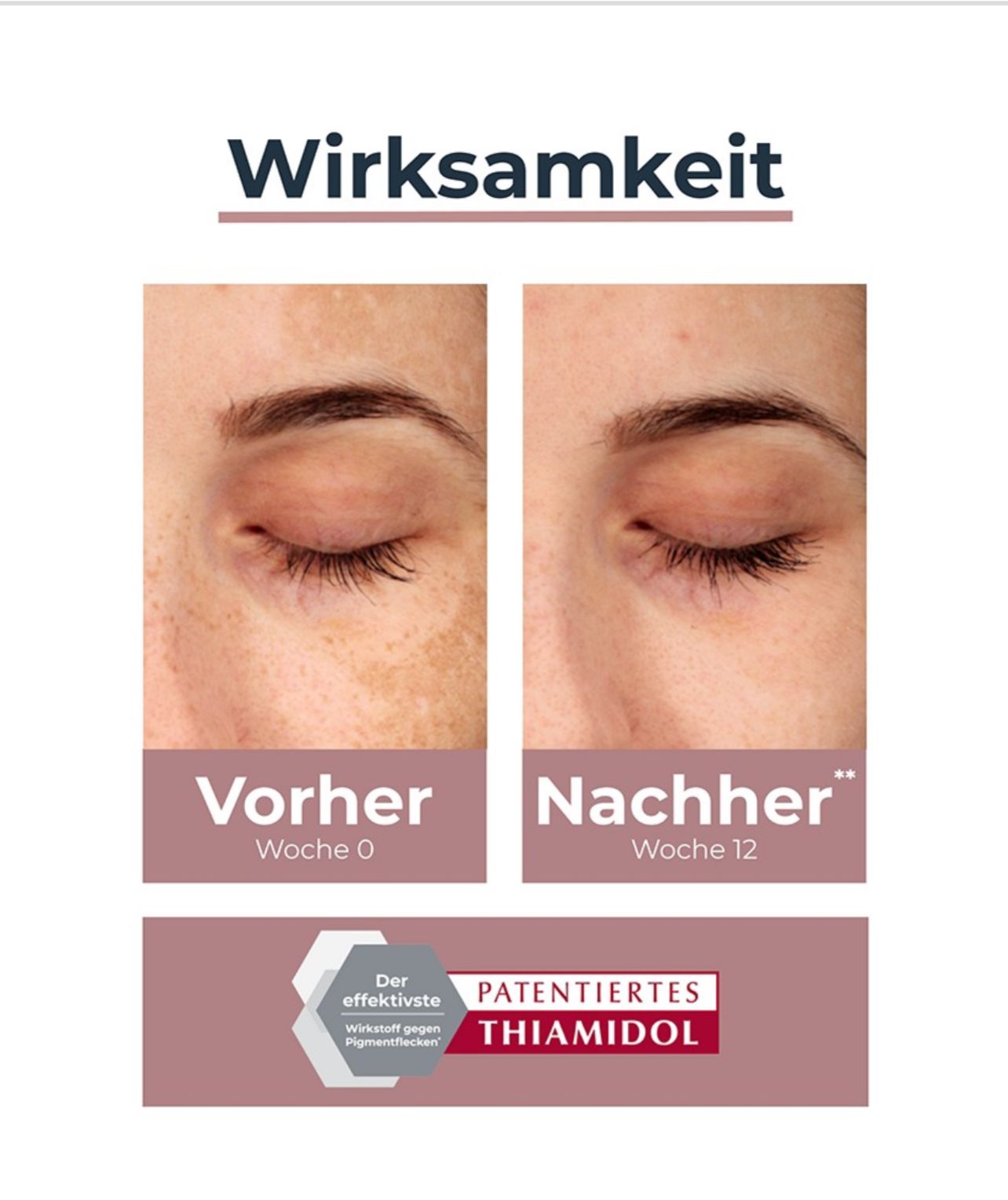 EUCERIN ANTI PIGMENT SERUM_1