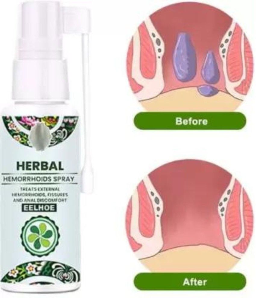Herbal hemorrhoids spray_2