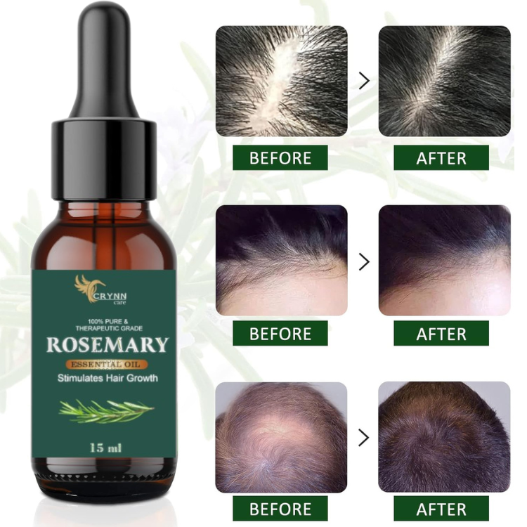 Crynn Care 100% Pure Rosemary Essential OIl 15Ml For Stimulates Hair Growth_1