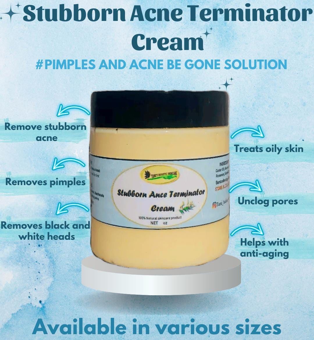 Stubborn Acne Terminator Cream _0