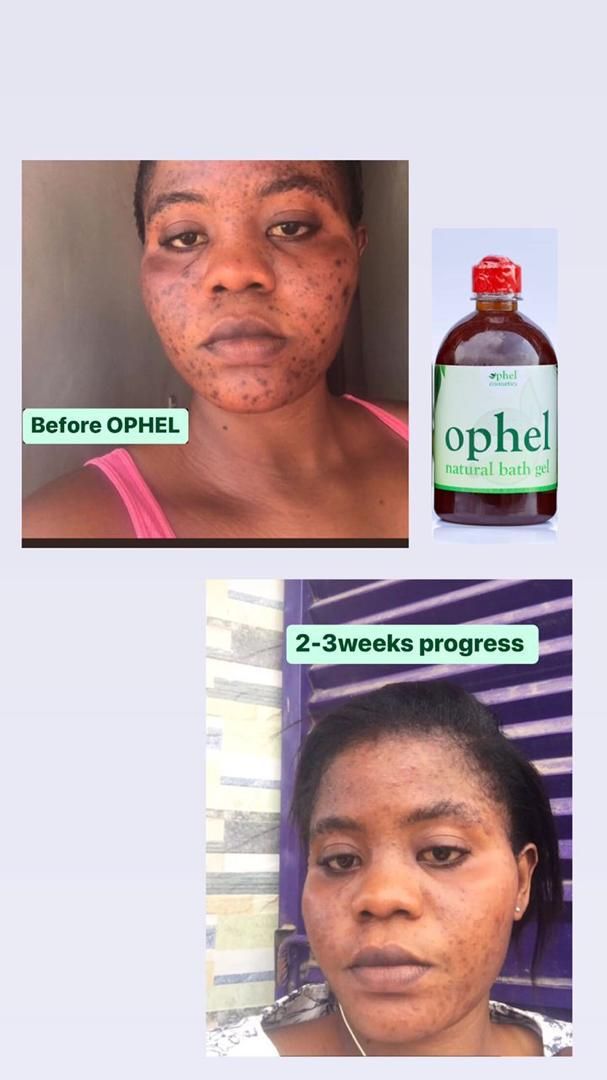 OPHEL NATURAL BATH GEL_3