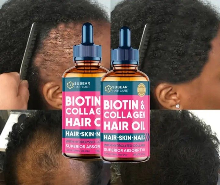 Biotin and collagen hair oil . Ideal for all hair types _1