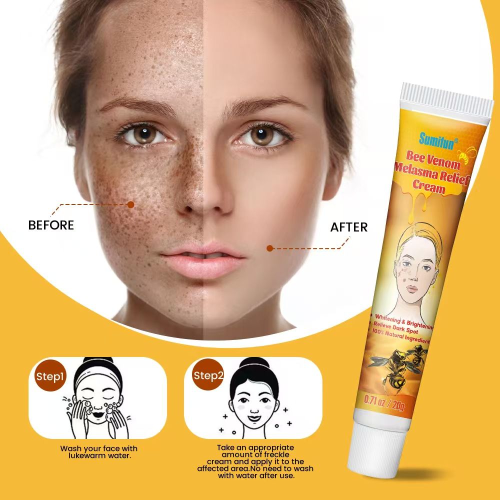 Bee Venom Melasma Relief Cream_4