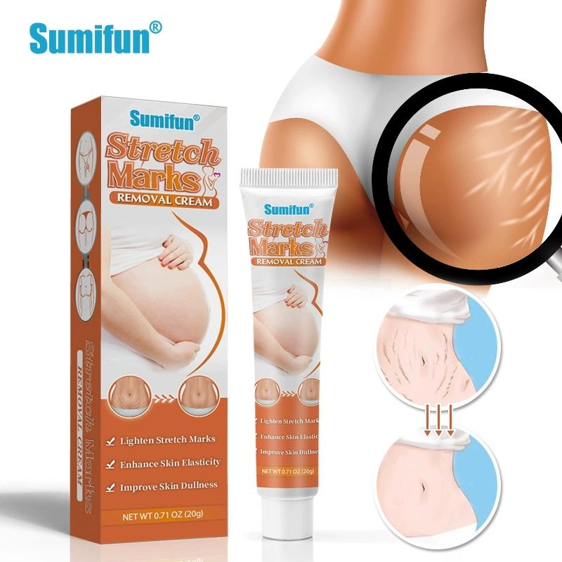 Sumifun Stretch Marks Removal Cream – Fade Stretch Marks & Scars, Moisturize & Firm Skin, 20g_12