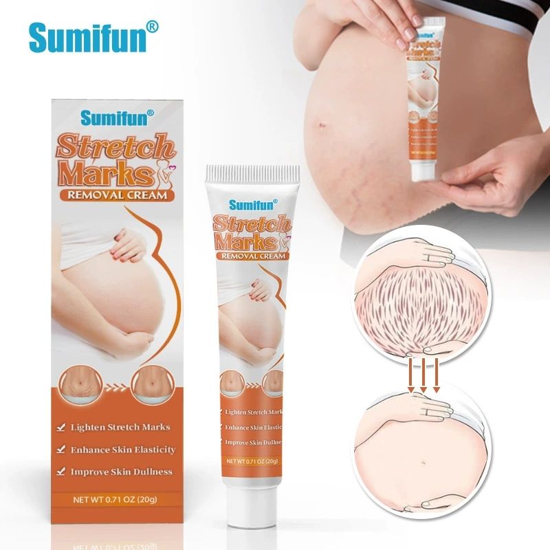 Sumifun Stretch Marks Removal Cream – Fade Stretch Marks & Scars, Moisturize & Firm Skin, 20g_13