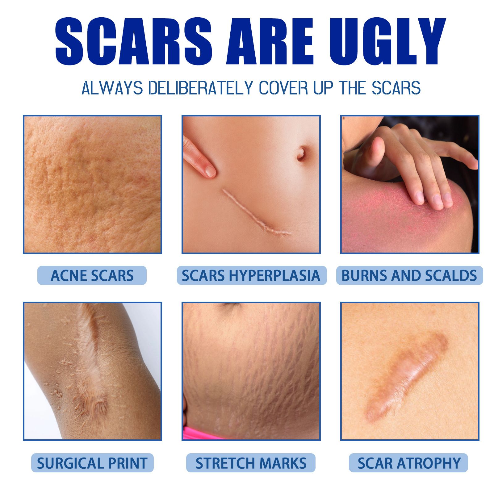 JaySuing Scar Removal Cream – Fade Scars, Stretch Marks & Acne_3