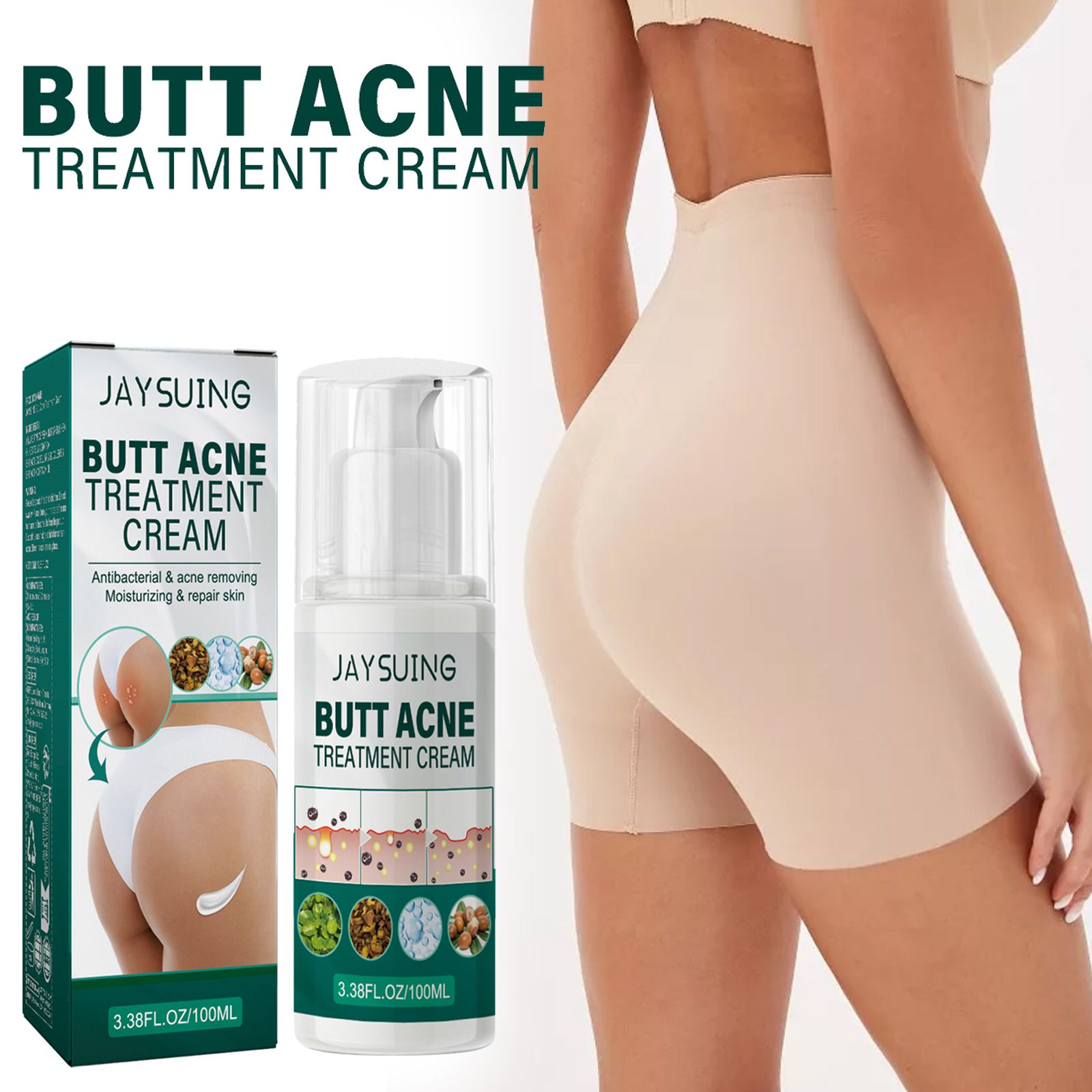 JaySuing Butt Acne Treatment Cream – Antibacterial & Skin Repair Formula_1