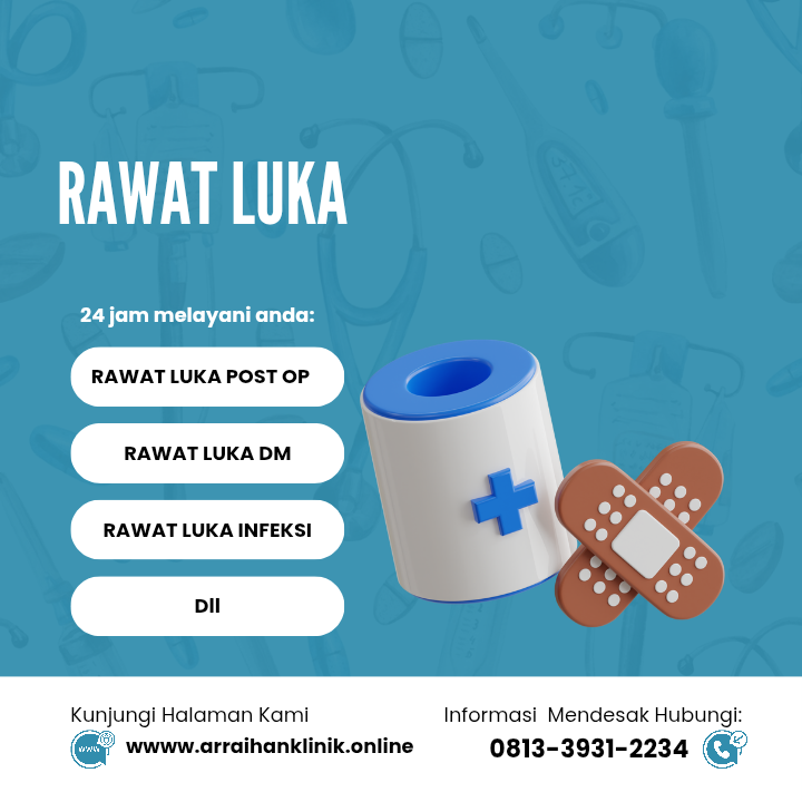 RAWAT LUKA MODERN_0