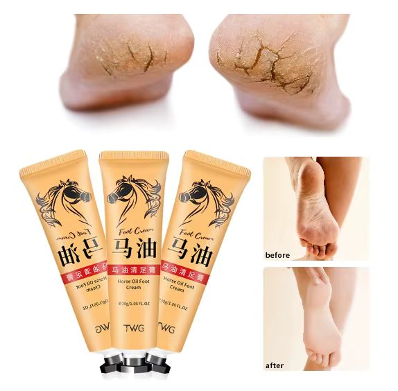  Anti-Crack Foot Cream_0
