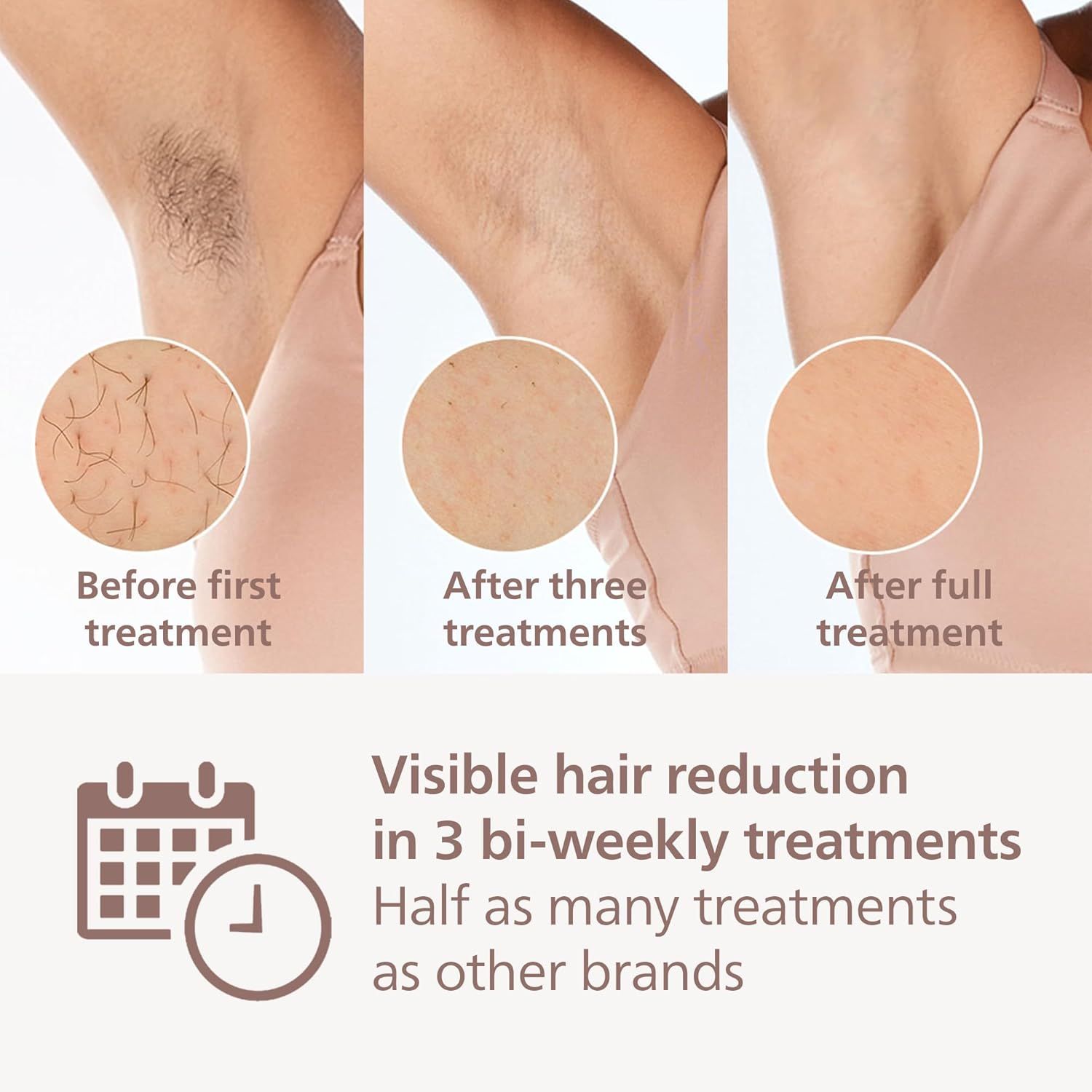 Philips Lumea IPL Hair Removal 8000 Series - Hair Removal Device with SenseIQ Technology, 2 Attachments for Body and Face, Corded Use (Model BRI944/00)_1