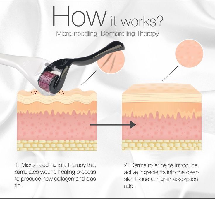 DERMA ROLLER PRO_1