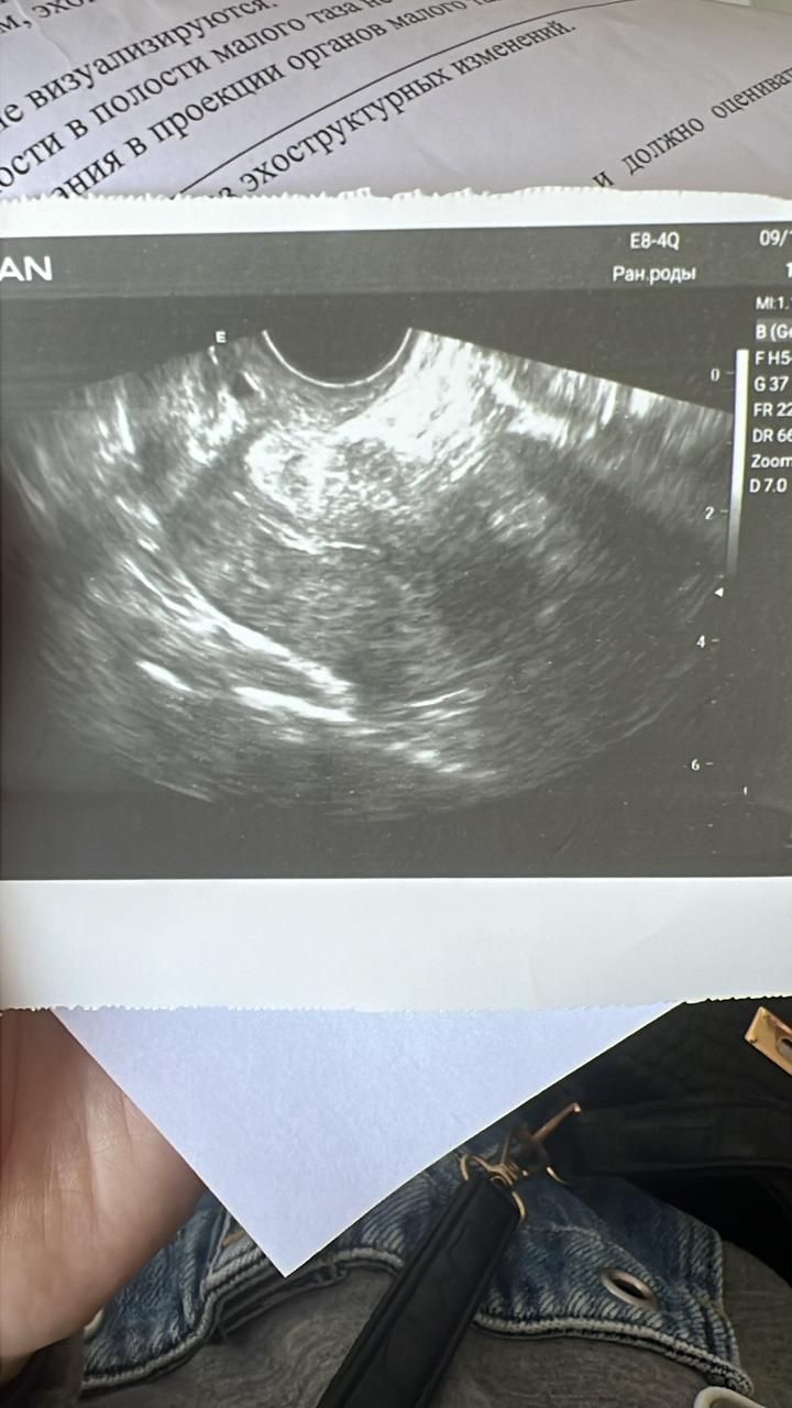 Kyrgyzstan Surrogacy & Egg Donor | Jalal-Abad | 29 Yrs Old, Blood Type A+, 163cm, 46kg | ID #120003 |_10