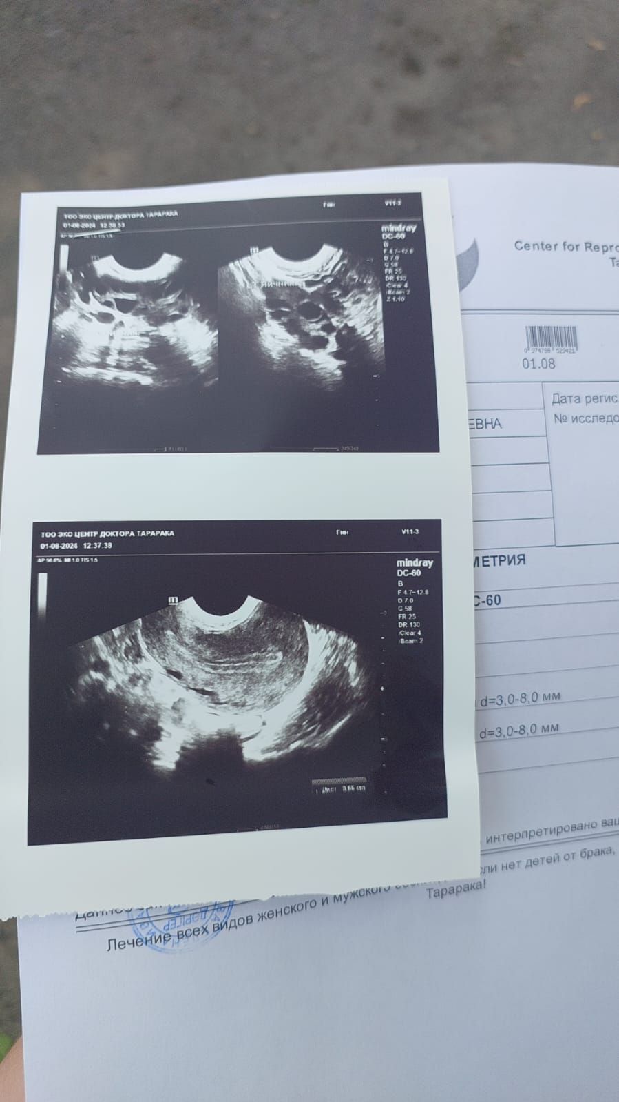 Kazakhstan Surrogacy & Egg Donor | Shymkent | 165cm, 67kg | ID #120011 |_2