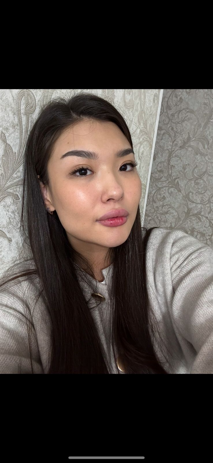 Kyrgyzstan Surrogacy & Egg Donor | Bishkek | 23 Yrs Old, Blood Type A, 162cm, 50kg | ID #120021 |_3