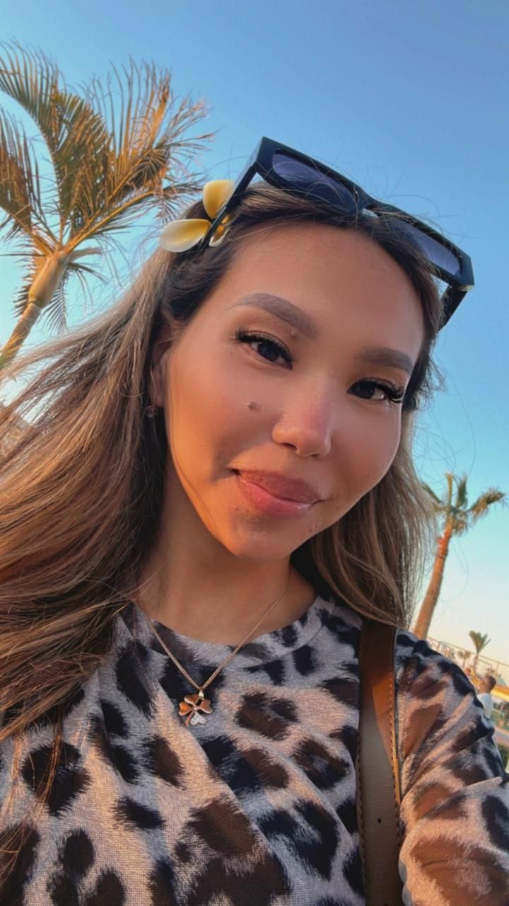 Kazakhstan Surrogacy & Egg Donor | 26 Yrs Old, Blood Type B, 165cm, 50kg | ID #120024 |_2