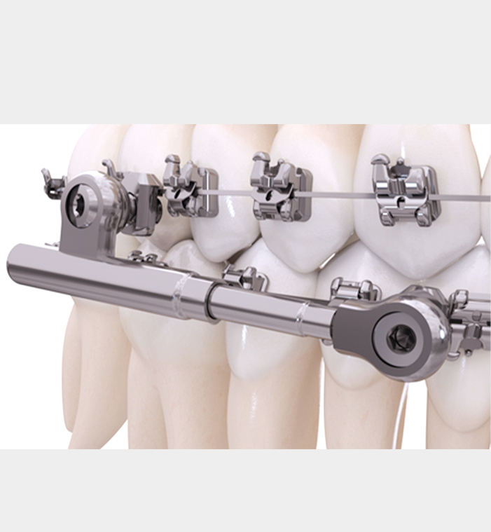 POWER SCOPE 2 CLASS II CORRECTOR_3